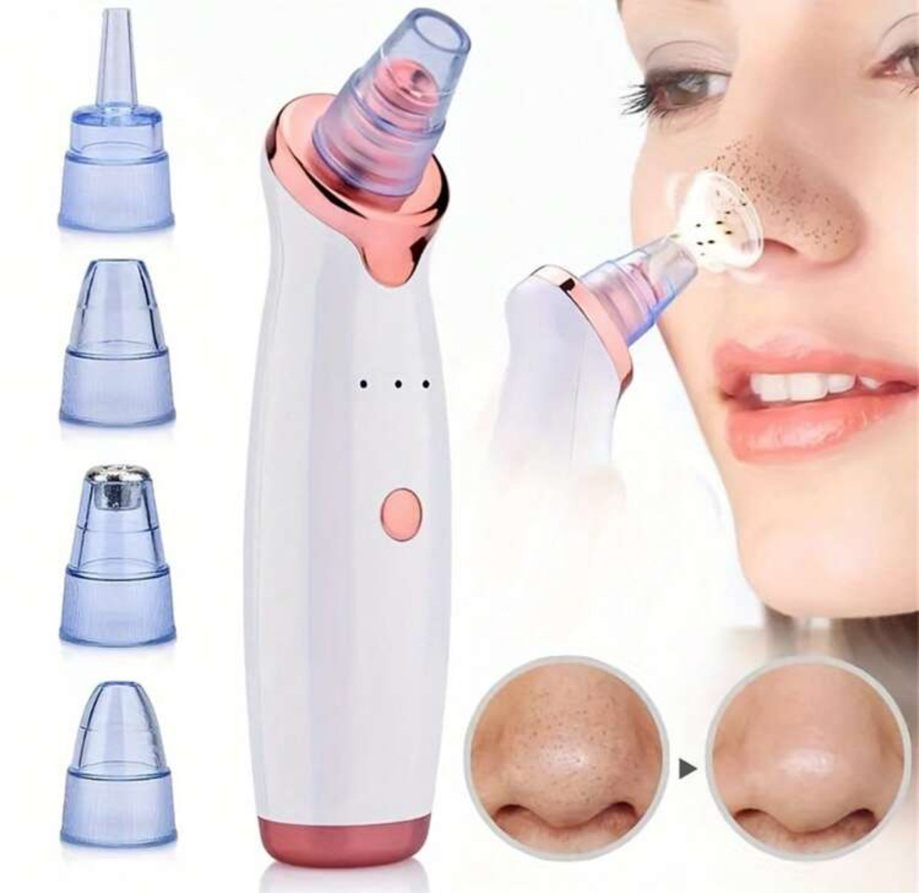Blackhead Remover